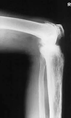 Hip 2026 MCQs: Board Review Questions & Answers (Part 3) - Figure 19