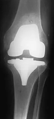 Hip 2026 MCQs: Board Review Questions & Answers (Part 4) - Figure 13