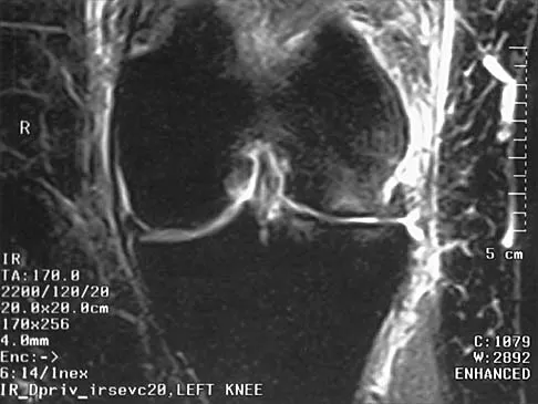 Hip 2026 MCQs: Board Review Questions & Answers (Part 4) - Figure 9