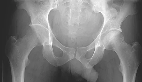 Hip & Knee Reconstruction Board Review 2007: High-Yield MCQs (Set 2) - Figure 14