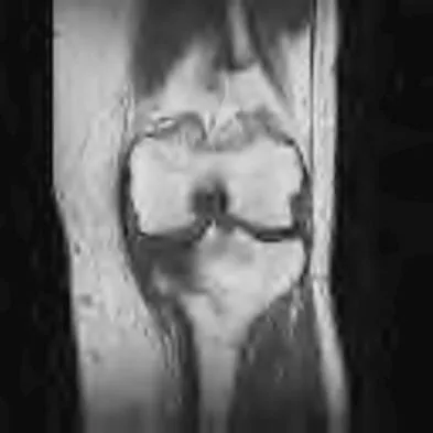 Hip & Knee Reconstruction Board Review 2007: High-Yield MCQs (Set 2) - Figure 19