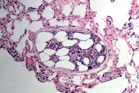 Hip & Knee Reconstruction Board Review 2007: High-Yield MCQs (Set 2) - Figure 4