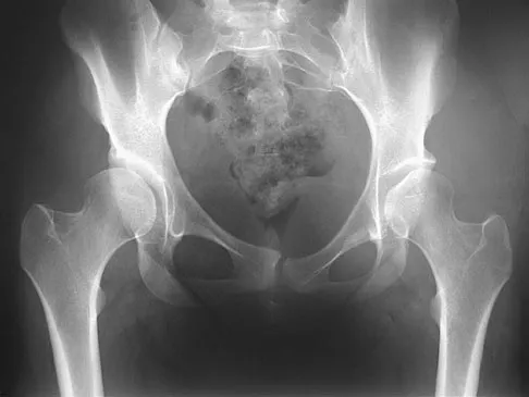 Hip & Knee Reconstruction Board Review 2007: High-Yield MCQs (Set 2) - Figure 9