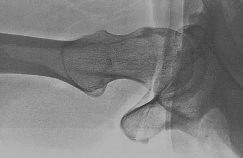 Hip & Knee Reconstruction Board Review 2007: High-Yield MCQs (Set 4) - Figure 7