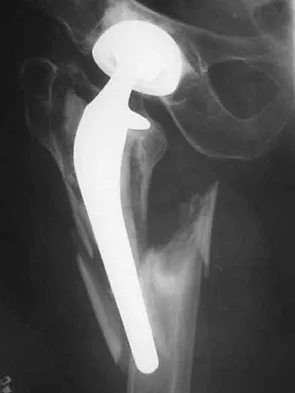 Hpkn 2026 MCQs: Board Review Questions & Answers (Part 1) - Figure 73