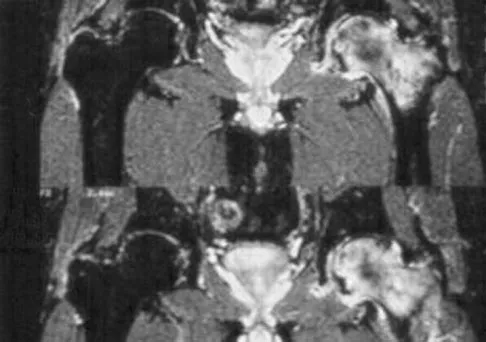 Hpkn 2026 MCQs: Board Review Questions & Answers (Part 1) - Figure 89