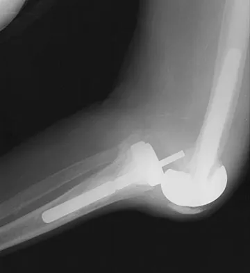 Hpkn 2026 MCQs: Board Review Questions & Answers (Part 2) - Figure 31