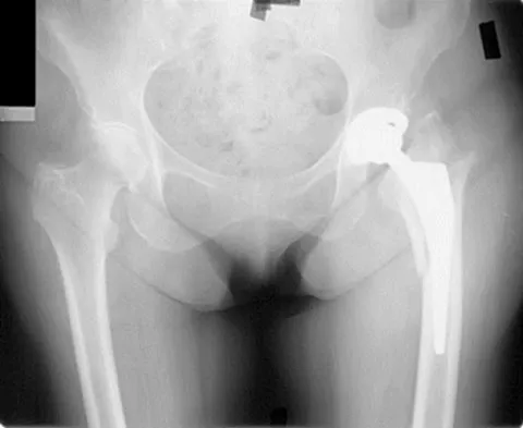 Hpkn 2026 MCQs: Board Review Questions & Answers (Part 2) - Figure 49