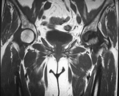 AAOS & ABOS Orthopedic MCQs (Part 3): Hip & Knee Pathologies | 2026 Board Review