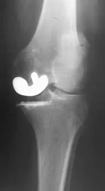 Hpkn 2026 MCQs: Board Review Questions & Answers (Part 4) - Figure 21