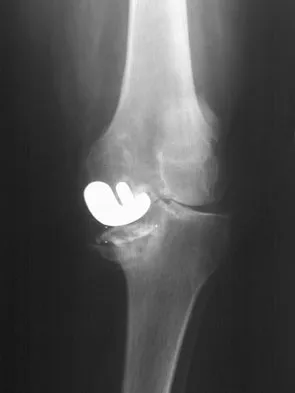 Hpkn 2026 MCQs: Board Review Questions & Answers (Part 4) - Figure 23