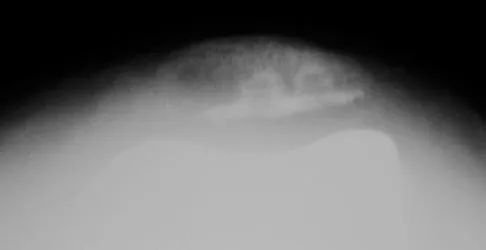 Hpkn 2026 MCQs: Board Review Questions & Answers (Part 4) - Figure 35