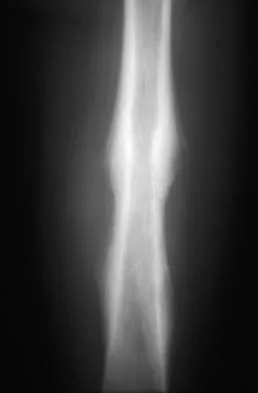 AAOS Orthopedic Basic MCQs (Set 1): Anatomy, Physiology & Biomechanics | 2026 Board Review