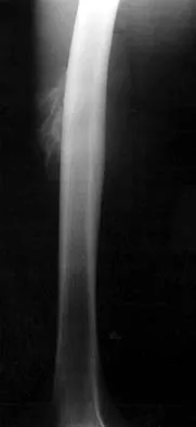 Mtd 2026 MCQs: Board Review Questions & Answers (Part 1) - Figure 107