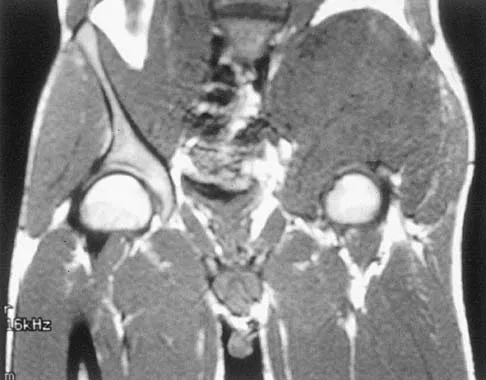 Mtd 2026 MCQs: Board Review Questions & Answers (Part 1) - Figure 11