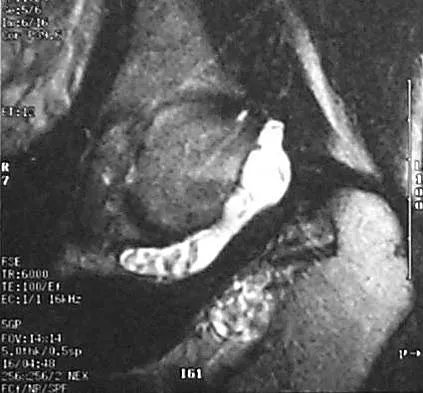 Mtd 2026 MCQs: Board Review Questions & Answers (Part 1) - Figure 125