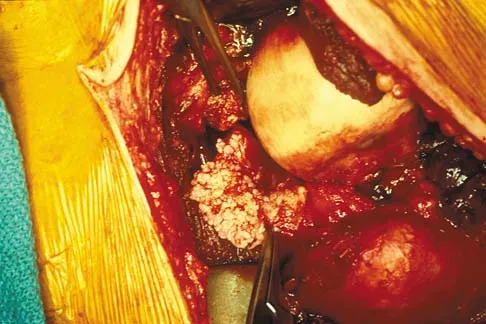 Mtd 2026 MCQs: Board Review Questions & Answers (Part 1) - Figure 127