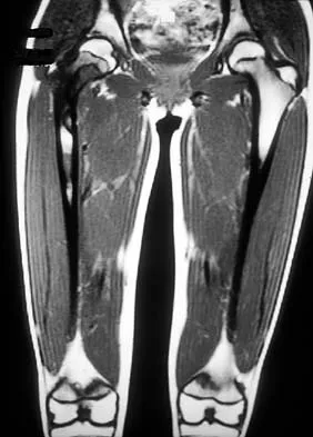 Mtd 2026 MCQs: Board Review Questions & Answers (Part 1) - Figure 133