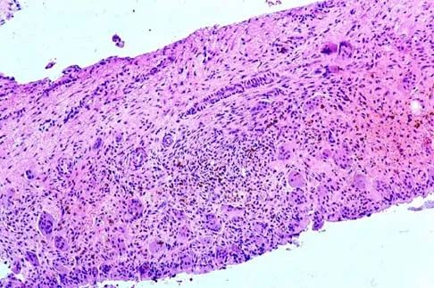 Mtd 2026 MCQs: Board Review Questions & Answers (Part 1) - Figure 147