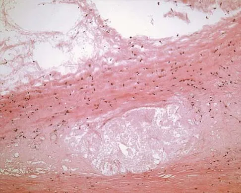 Mtd 2026 MCQs: Board Review Questions & Answers (Part 1) - Figure 153