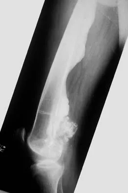 Mtd 2026 MCQs: Board Review Questions & Answers (Part 1) - Figure 189