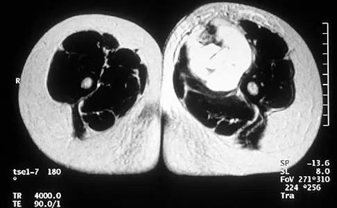 Mtd 2026 MCQs: Board Review Questions & Answers (Part 1) - Figure 205