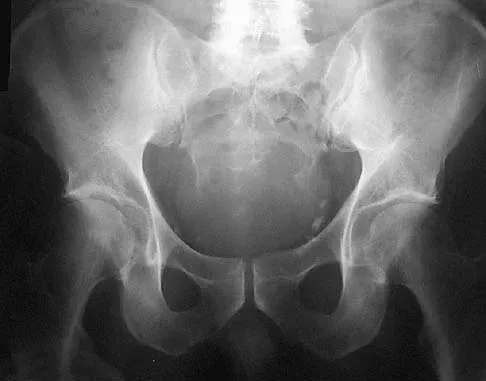 Mtd 2026 MCQs: Board Review Questions & Answers (Part 1) - Figure 209