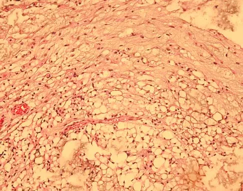 Mtd 2026 MCQs: Board Review Questions & Answers (Part 1) - Figure 215