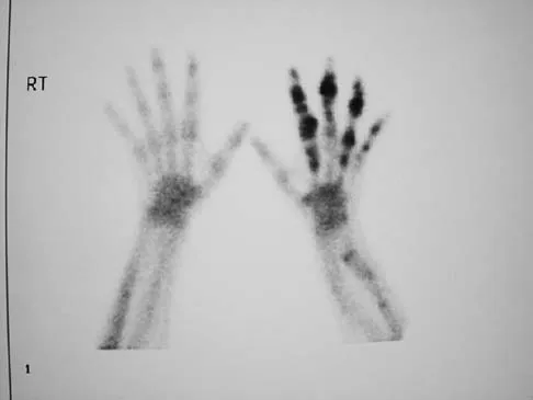 Mtd 2026 MCQs: Board Review Questions & Answers (Part 1) - Figure 227