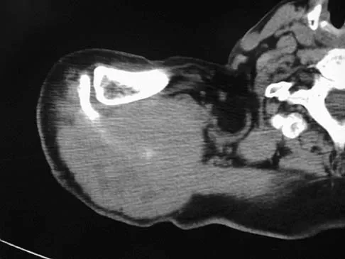 Mtd 2026 MCQs: Board Review Questions & Answers (Part 1) - Figure 231