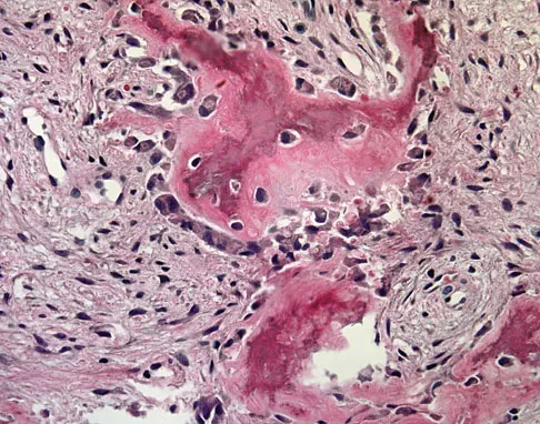 Mtd 2026 MCQs: Board Review Questions & Answers (Part 1) - Figure 235