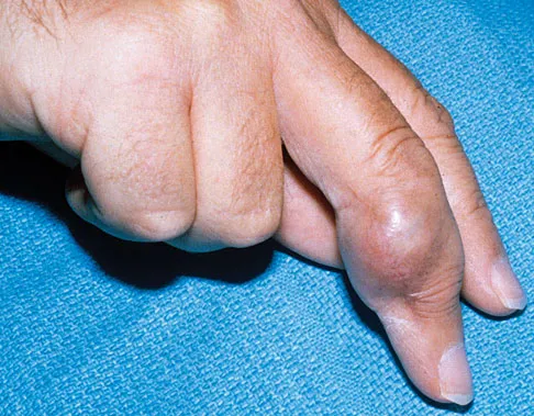 Mtd 2026 MCQs: Board Review Questions & Answers (Part 1) - Figure 237