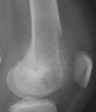 Mtd 2026 MCQs: Board Review Questions & Answers (Part 1) - Figure 243