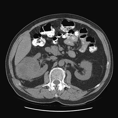 Mtd 2026 MCQs: Board Review Questions & Answers (Part 1) - Figure 259