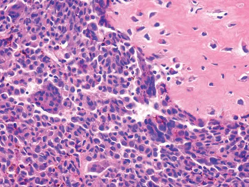 Mtd 2026 MCQs: Board Review Questions & Answers (Part 1) - Figure 271