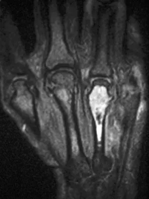 Mtd 2026 MCQs: Board Review Questions & Answers (Part 1) - Figure 277