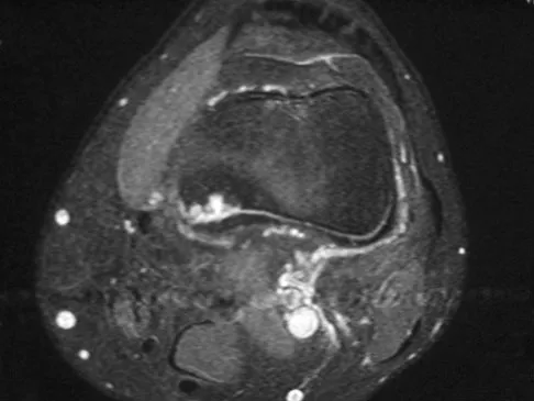 Mtd 2026 MCQs: Board Review Questions & Answers (Part 1) - Figure 283