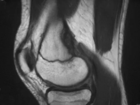 Mtd 2026 MCQs: Board Review Questions & Answers (Part 1) - Figure 287