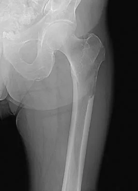 Mtd 2026 MCQs: Board Review Questions & Answers (Part 1) - Figure 289