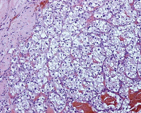 Mtd 2026 MCQs: Board Review Questions & Answers (Part 1) - Figure 295