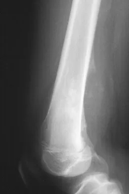 Mtd 2026 MCQs: Board Review Questions & Answers (Part 1) - Figure 299