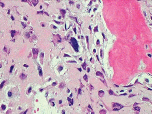 Mtd 2026 MCQs: Board Review Questions & Answers (Part 1) - Figure 307