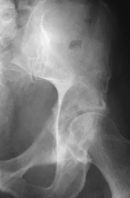 Mtd 2026 MCQs: Board Review Questions & Answers (Part 1) - Figure 315