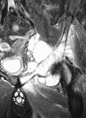 Mtd 2026 MCQs: Board Review Questions & Answers (Part 1) - Figure 317