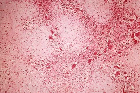 Mtd 2026 MCQs: Board Review Questions & Answers (Part 1) - Figure 43