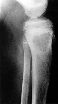 Mtd 2026 MCQs: Board Review Questions & Answers (Part 1) - Figure 81