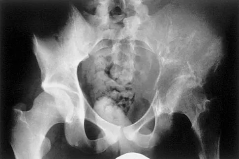 Mtd 2026 MCQs: Board Review Questions & Answers (Part 1) - Figure 9