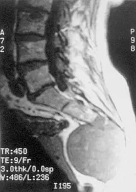 Mtd 2026 MCQs: Board Review Questions & Answers (Part 1) - Figure 97