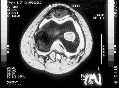 Mtd 2026 MCQs: Board Review Questions & Answers (Part 2) - Figure 119