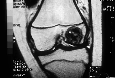 Mtd 2026 MCQs: Board Review Questions & Answers (Part 2) - Figure 121